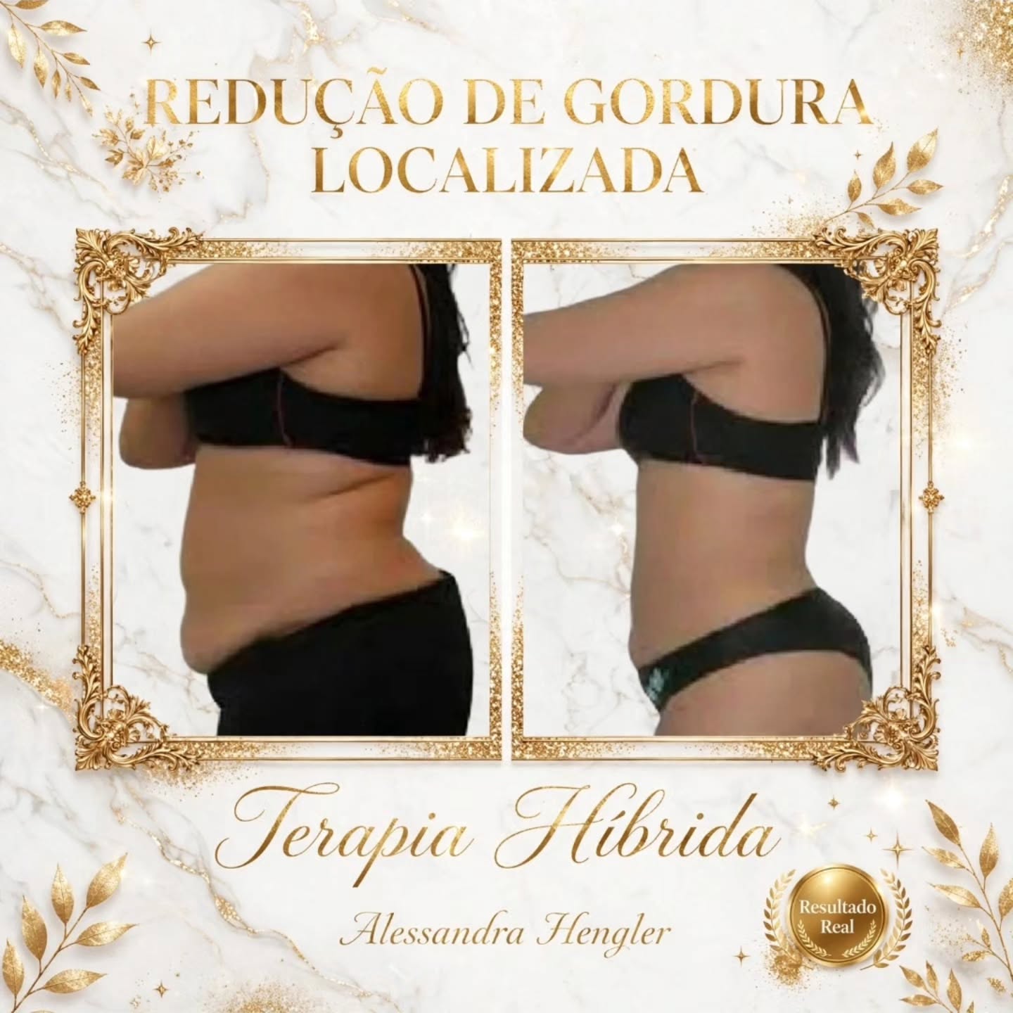Antes e depois de terapia híbrida